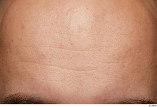  HD Face Skin Neeo face forehead skin pores skin texture wrinkles 0002.jpg